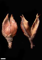 Veronica diosmifolia. Capsules. Scale = 1 mm.
 Image: W.M. Malcolm © Te Papa CC-BY-NC 3.0 NZ